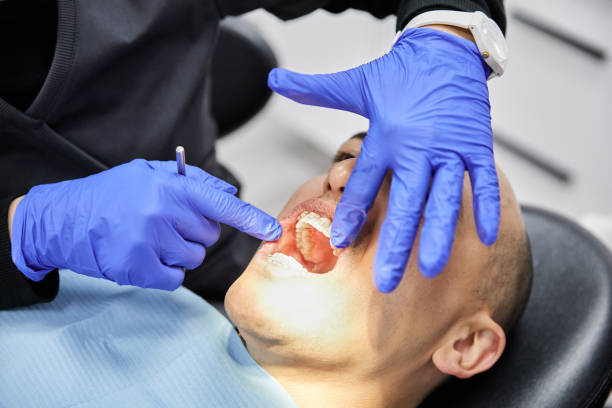 Best Dentist for Tooth Abscess  in Milan, OH
